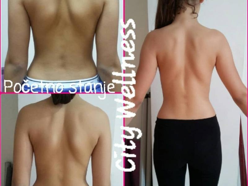 Korektivna gimnastika